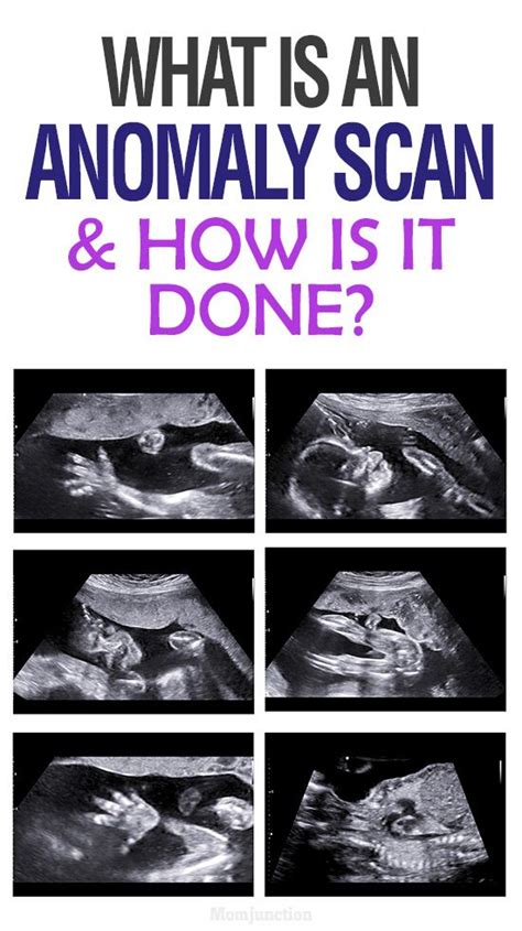 what is cas ultrasound|Anomaly Scan in Pregnancy: Why It's Essential To Have it Done.